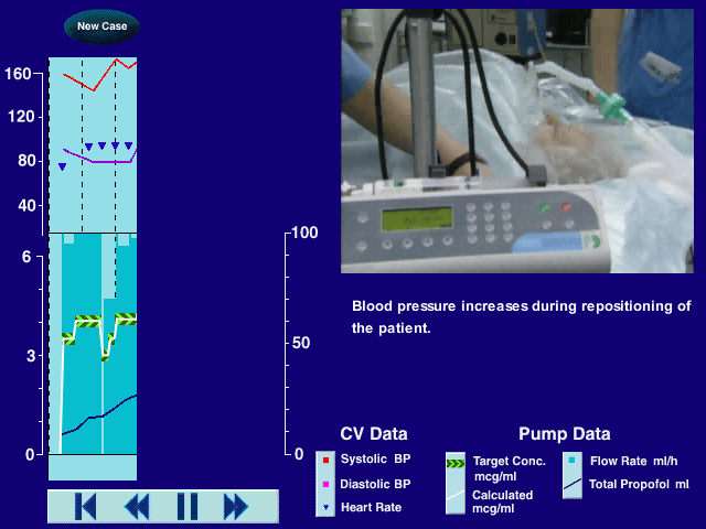 Diprifusor-case-study-640-x-480